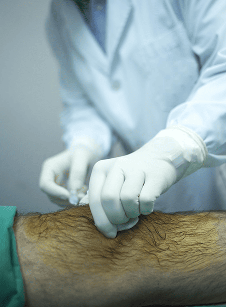 cirugia-vascular-cerca-en-cdmx.png