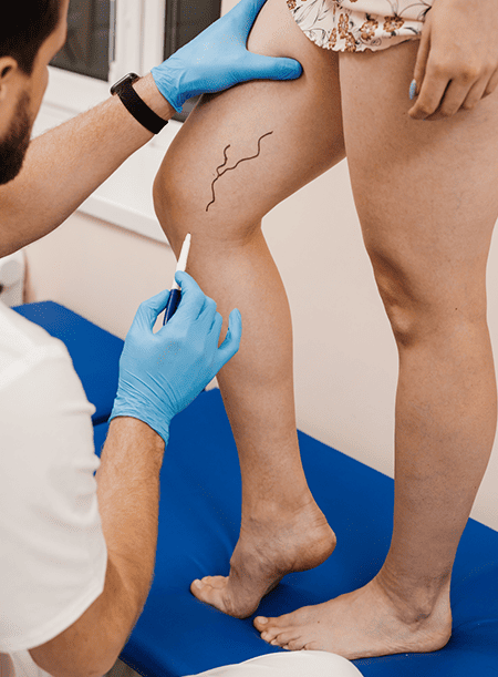 Cuanto Cuesta Una Consulta De Diagnostico Y Tratamiento De Linfedema En Benito Juarez Cdmx