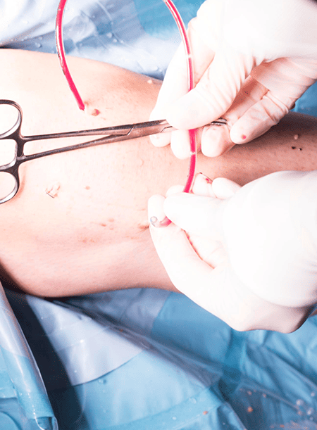 endovascular-certificado-en-cdmx.png