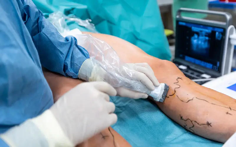 Revascularización periférica ofrecido por Centro de enfermedades circulatorias y pie diabético